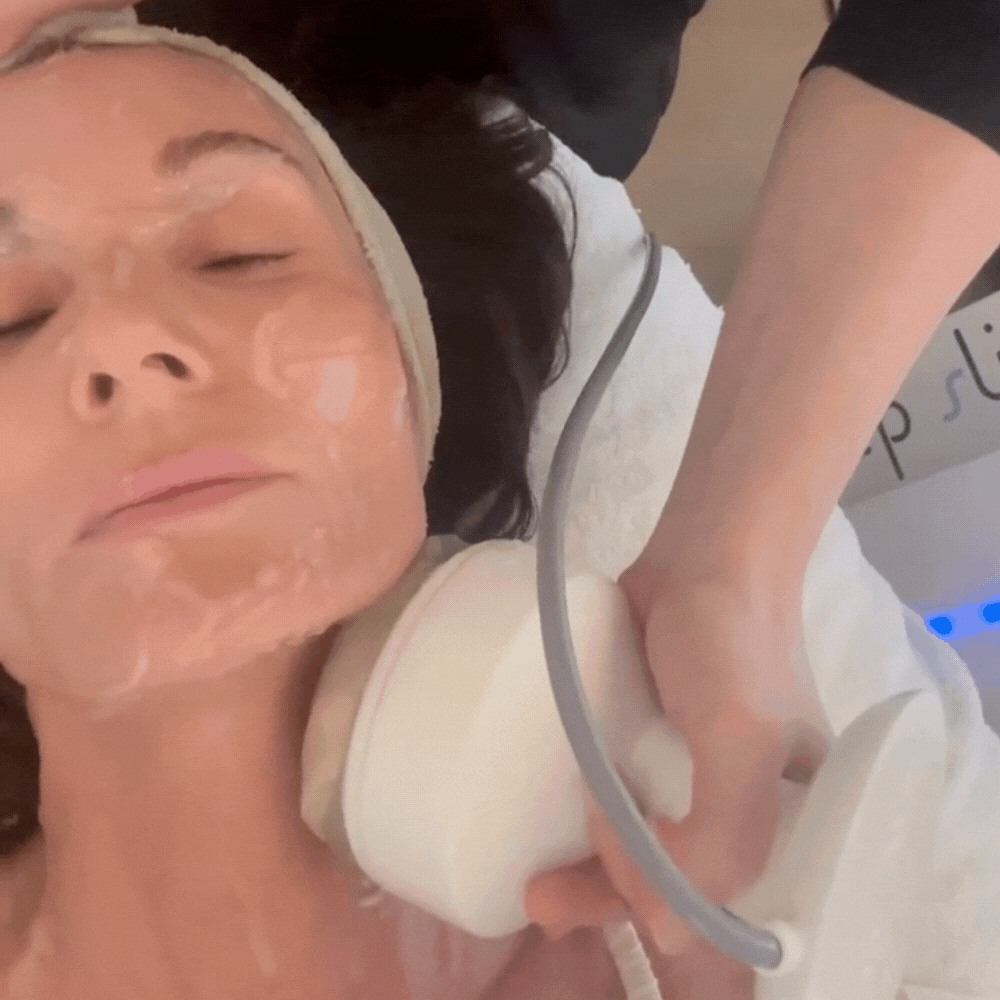 Skin Sculpting - Deep Lift: Det Naturlige smertefrie lift uden Kirurgi