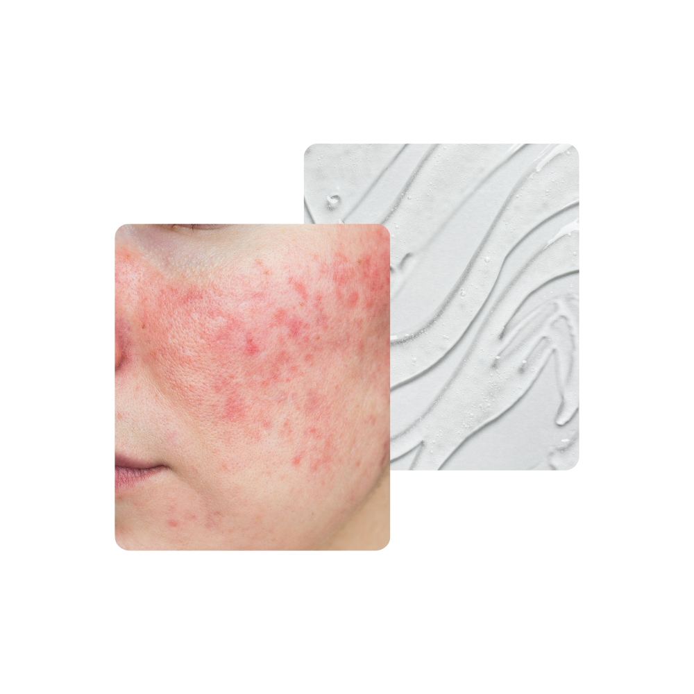 Rodhud-serum.png